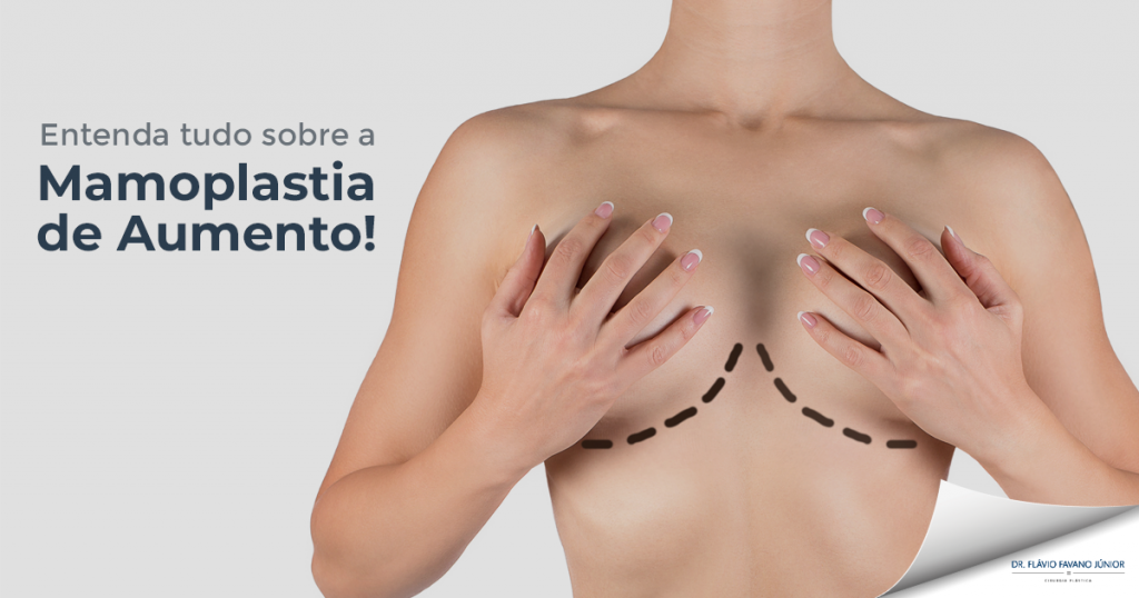 mamoplastia de aumento