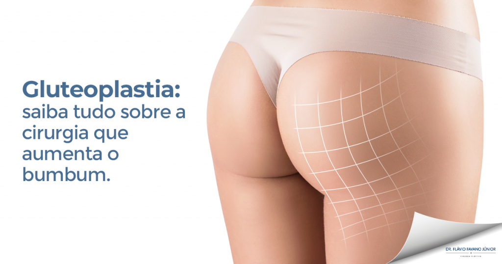 tudo sobre a gluteoplastia