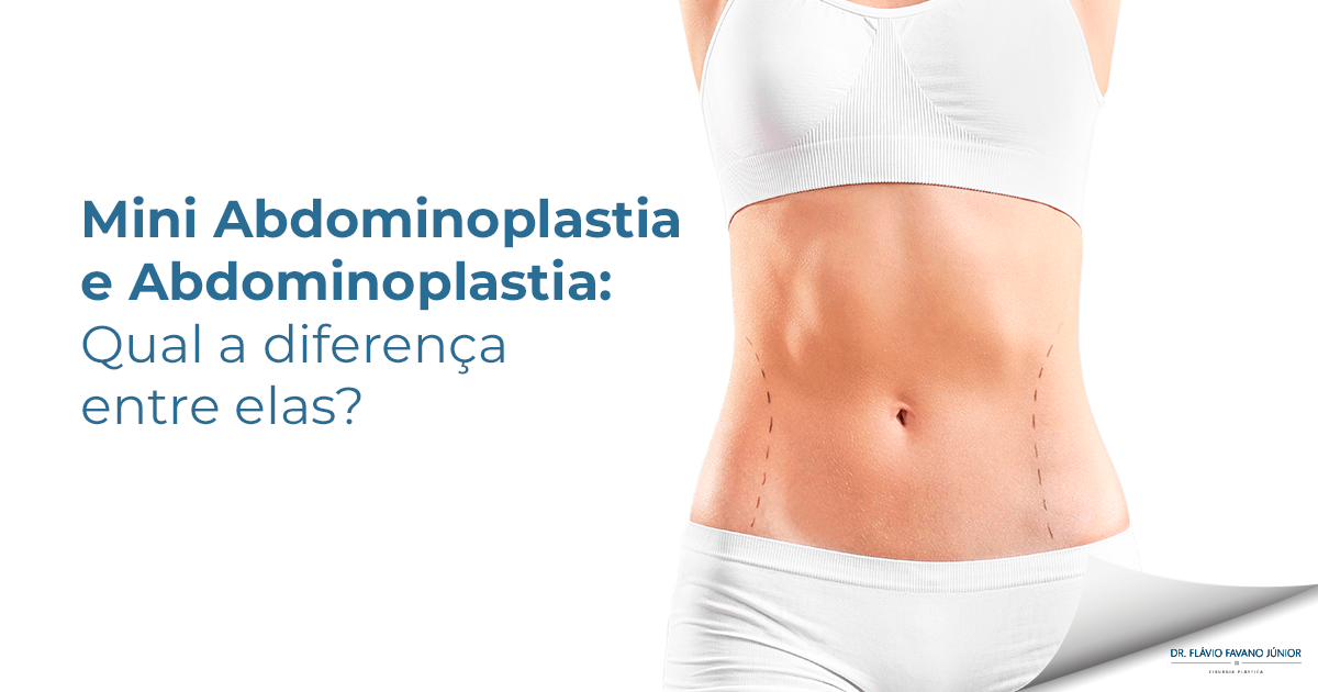 Miniabdominoplastia e abdominoplastia: Qual a diferença entre elas?