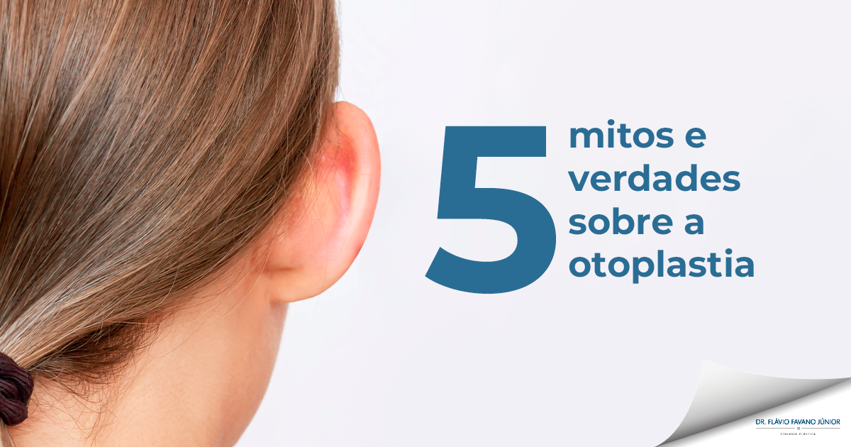 5 mitos e verdades sobre a Otoplastia