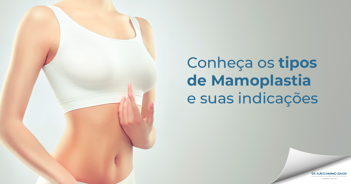 Mamoplastia: quais os tipos e indicações?